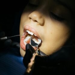Profesional de Limpieza Dental con Ultrasonido