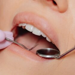 Plan de tratamiento detallado